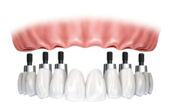 Equipo profesional de la clínica dental